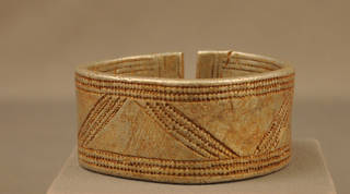 Aluminum bracelet with evidence of corrosion